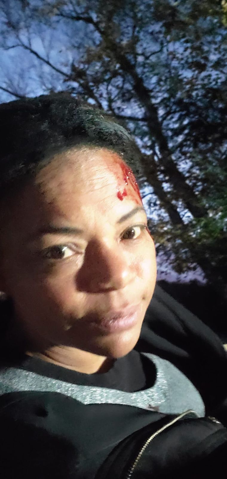 An actor with fake blood on her forehead in the woods at dusk